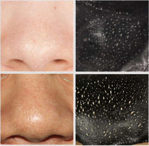 Hot Sale 10pcs Remove High Quality Mineral Mud Nose Blackhead Pore Cleansing Cleaner Removal Nose Membranes Strips 2017 Anne