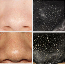 TOP Quality 5pcs Remove High Quality Mineral Mud Nose Blackhead Pore Cleansing Cleaner Removal Nose Membranes Strips Anne